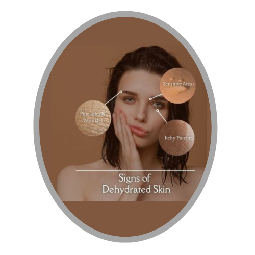 Dryness / Hydration